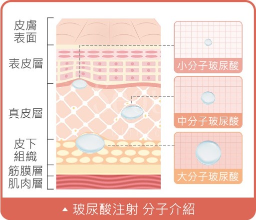 瑞絲朗_5大優勢_首爾醫美