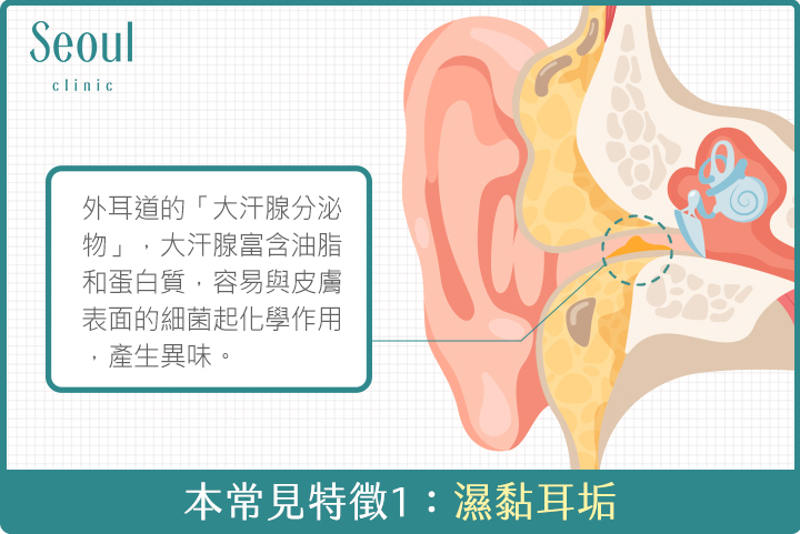 狐臭-狐臭常見特徵1：濕黏耳垢-首爾醫美