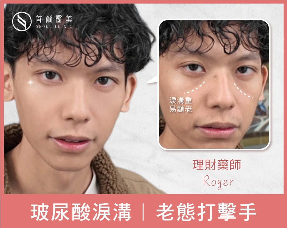 玻尿酸黑眼圈淚溝填補-理財藥師-首爾醫美診所 玻尿酸黑眼圈淚溝填補-理財藥師-首爾醫美診所