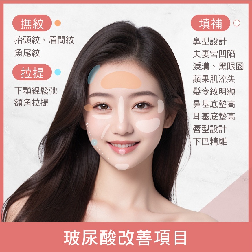 玻尿酸適應部位-臉部適應13部位一次看-首爾醫美診所 玻尿酸適應部位-臉部適應13部位一次看-首爾醫美診所