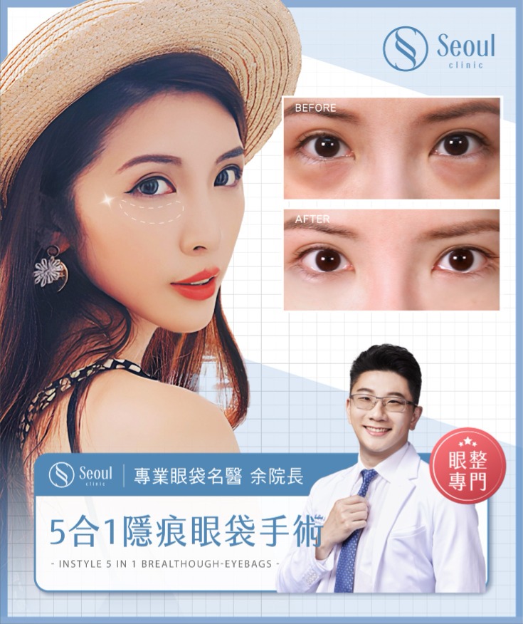 首爾醫美眼袋手術_網紅實證 首爾醫美眼袋手術_網紅實證