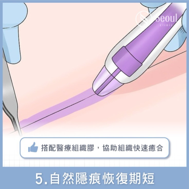 20251003_seo熱門文_眼袋專門診所!5合1隱痕眼袋手術特色、費用,fb、dcard眾多好評推薦!_2_工作區域-1-複本-16 20251003_seo熱門文_眼袋專門診所!5合1隱痕眼袋手術特色、費用,fb、dcard眾多好評推薦!_2_工作區域-1-複本-16