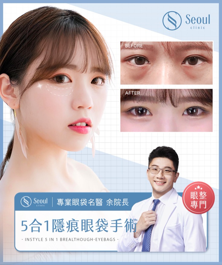 首爾醫美眼袋手術_網紅實證 首爾醫美眼袋手術_網紅實證
